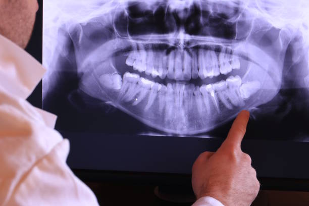 Best Emergency Wisdom Teeth Removal in South Greeley, WY