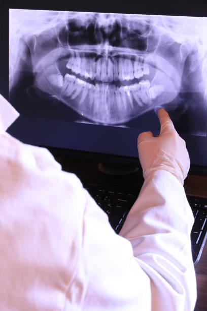 Best Emergency Tooth Extraction in South Greeley, WY