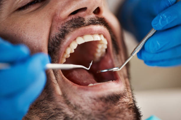 Best Emergency Broken Tooth Repair in South Greeley, WY